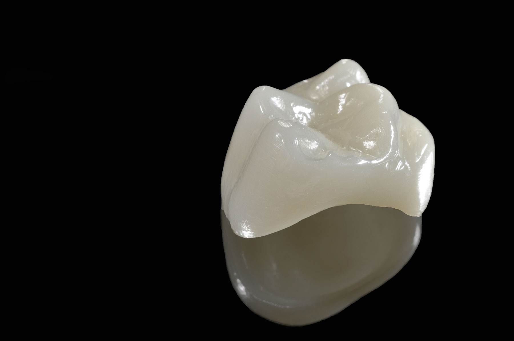 Cerec Dental Crowns - San Diego, CA & Pacific Beach, CA - San Diego Art Of Dentistry