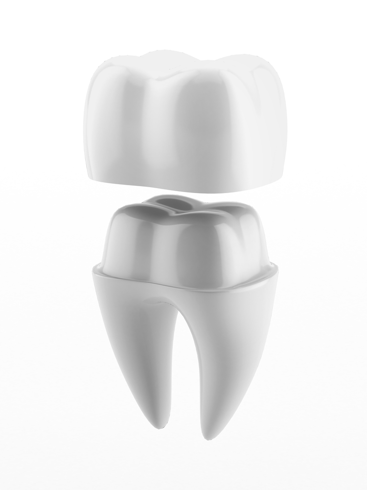 Dental crown