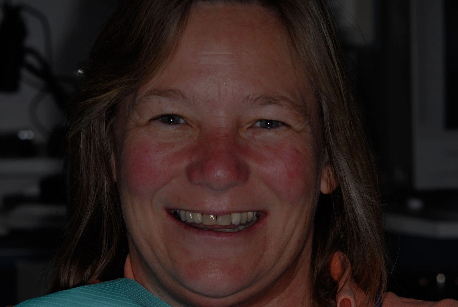 Before operation photo of patient