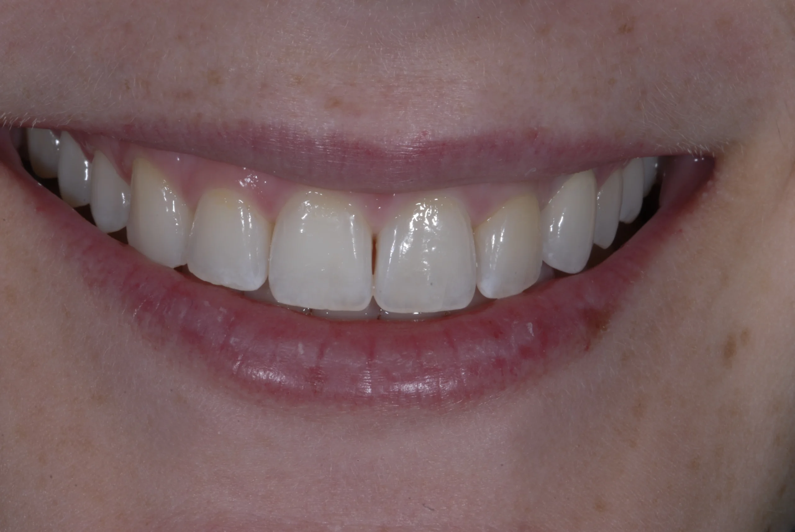 After Image