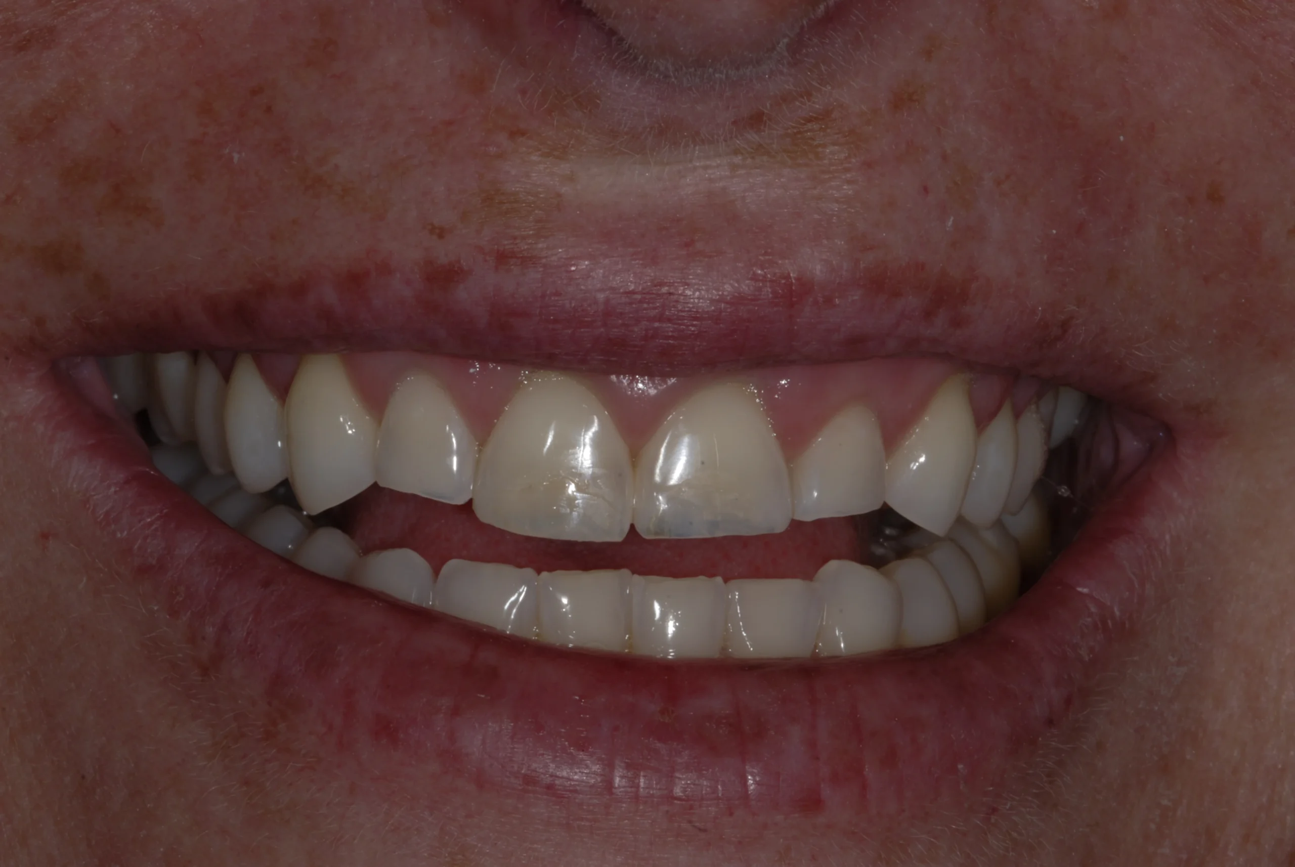 Before Image